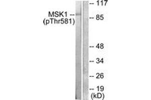 Western blot analysis of extracts from RAW264. (MSK1 抗体  (pThr581))