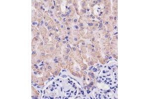 Immunohistochemistry (Paraffin-embedded Sections) (IHC (p)) image for anti-Solute Carrier Family 3 (Activators of Dibasic and Neutral Amino Acid Transport), Member 2 (SLC3A2) (AA 588-615), (C-Term) antibody (ABIN654111)