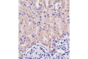 (ABIN654111 and ABIN2843993) staining SLC3A2 in human kidney tissue sections by Immunohistochemistry (IHC-P - paraformaldehyde-fixed, paraffin-embedded sections). (SLC3A2 抗体  (C-Term))
