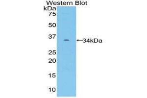 Western Blotting (WB) image for anti-Frizzled Family Receptor 10 (FZD10) (AA 235-495) antibody (ABIN1858934) (FZD10 抗体  (AA 235-495))