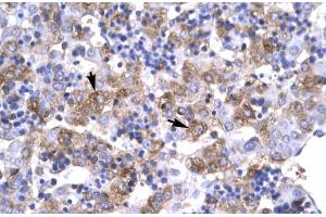 Human Liver; Rabbit Anti-POU1F1 Antibody. (POU1F1 抗体  (C-Term))