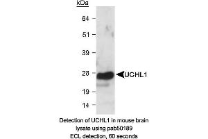 Image no. 1 for anti-Ubiquitin Carboxyl-terminal Esterase L1 (Ubiquitin Thiolesterase) (UCHL1) (AA 100-200) antibody (ABIN363498)
