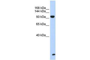 WB Suggested Anti-TNRC6B Antibody Titration:  0. (TNRC6B 抗体  (N-Term))