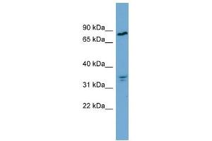 APEH antibody used at 1 ug/ml to detect target protein. (APEH 抗体  (Middle Region))