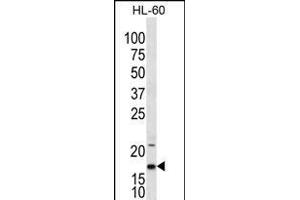 IL1F5 Antibody (N-term) (ABIN656238 and ABIN2845554) western blot analysis in HL-60 cell line lysates (35 μg/lane). (FIL1d 抗体  (N-Term))