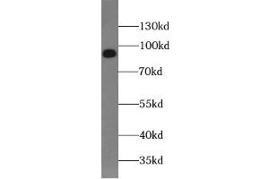 Western blot analysis of HeLa cells subjected to SDS-PAGE, using SUN1 antibody. (SUN1 抗体  (AA 4-257))