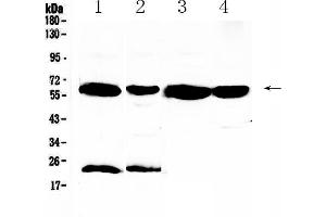 Western blot analysis of UGT1A1 using anti-UGT1A1 antibody . (UGT1A1 抗体  (AA 316-533))