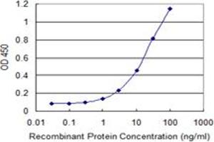 Detection limit for recombinant GST tagged ZNF263 is 0. (ZNF263 抗体  (AA 1-683))
