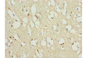 Immunohistochemistry of paraffin-embedded human brain tissue using ABIN7176144 at dilution of 1:100 (ZNF195 抗体  (AA 1-250))