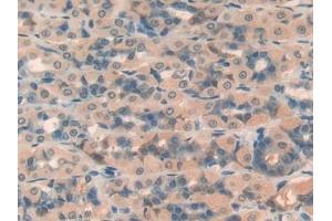 Detection of TBG in Rat Intestine Tissue using Polyclonal Antibody to Thyroxine Binding Globulin (TBG) (SERPINA7 抗体  (AA 114-391))