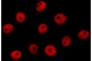 Immunofluorescence (fixed cells) (IF/ICC) image for anti-cAMP Responsive Element Binding Protein 1 (CREB1) (pSer133) antibody (ABIN6256130)