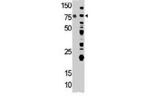 Western blot analysis of ACO2 polyclonal antibody  in mouse heart (left) and 293 (right) cell lysates (35 ug/lane). (ACO2 抗体  (Internal Region))