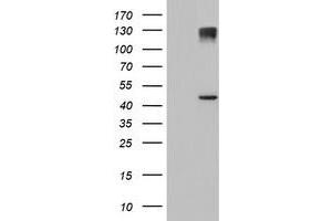 Western Blotting (WB) image for anti-1-Acylglycerol-3-Phosphate O-Acyltransferase 5 (Lysophosphatidic Acid Acyltransferase, Epsilon) (AGPAT5) antibody (ABIN1496500)