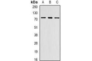 Western blot analysis of PRDM6 expression in Jurkat (A), MCF7 (B), mouse lung (C) whole cell lysates. (PRDM6 抗体)