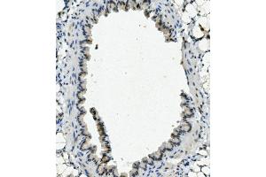 IHC analysis of NHEJ1 using anti-NHEJ1 antibody (ABIN7599198).