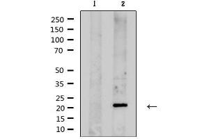 Western blot analysis of extracts from rat brain , using KCNMB1 Antibody.