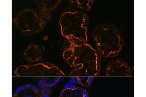 Immunofluorescence analysis of Human placenta cells using LDB3 Polyclonal Antibody at dilution of 1:100. (LIM Domain Binding 3 Protein 抗体)