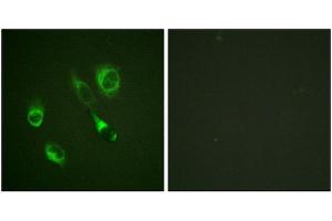 Immunofluorescence staining of methanol-fixed HeLa cells using EPHA2/3/4 (Phospho-Tyr588/596) Antibody. (EPH Receptor A2 抗体  (pTyr588, pTyr596))