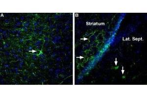 Expression of Neurexin 3α in rat and mouse brain - Immunohistochemical staining of rat entorhinal cortex (A) and mouse striatum and lateral septum (B) using Anti-Neurexin 3α (extracellular) Antibody (ABIN7043359, ABIN7044678 and ABIN7044679), (1:400). (Neurexin 3 抗体  (Extracellular, N-Term))