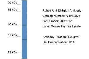 Western Blotting (WB) image for anti-SH3-Domain GRB2-Like Endophilin B1 (SH3GLB1) (N-Term) antibody (ABIN2787862) (SH3GLB1 抗体  (N-Term))