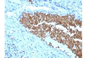 Immunohistochemistry (IHC) image for anti-Spectrin alpha 1, Erythrocytic (SPTA1) (AA 356-475) antibody (ABIN6940644)