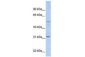 ZFYVE19 antibody used at 0. (ZFYVE19 抗体  (C-Term))