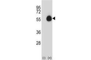Western blot analysis of CD33 antibody and 293 cell lysate (2 ug/lane) either nontransfected (Lane 1) or transiently transfected (2) with the CD33 gene.