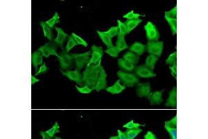 Immunofluorescence analysis of A549 cells using HAGH Polyclonal Antibody (HAGH 抗体)