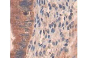 Used in DAB staining on fromalin fixed paraffin- embedded Kidney tissue (PI4KA 抗体  (AA 1-300))