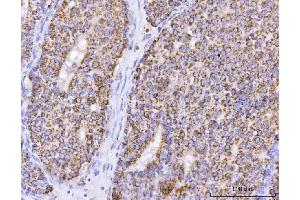 IHC analysis of ATP5F1B using anti-ATP5F1B antibody (ABIN7599866). (Atp5f1b (AA 123-529) 抗体)