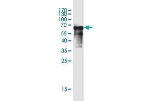 Western Blot detection against Immunogen (65. (SERTAD4 抗体  (AA 1-356))