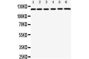 Western Blotting (WB) image for anti-Coxsackie Virus and Adenovirus Receptor (CXADR) (AA 313-328), (C-Term) antibody (ABIN3044083) (Coxsackie Adenovirus Receptor 抗体  (C-Term))