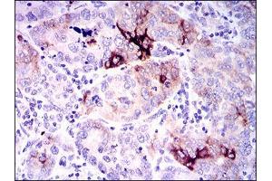 Immunohistochemistry (IHC) image for anti-Secreted phosphoprotein 1 (SPP1) (AA 167-314) antibody (ABIN1098149)