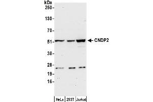 Western Blotting (WB) image for anti-CNDP Dipeptidase 2 (Metallopeptidase M20 Family) (CNDP2) (AA 425-475) antibody (ABIN7450131)