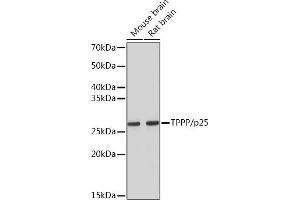 Western blot analysis of extracts of various cell lines, using TPPP/p25 Rabbit mAb (ABIN7271031) at 1:5000 dilution. (Tppp 抗体)