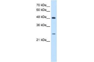 SH3BGR antibody used at 0. (SH3BGR 抗体  (N-Term))