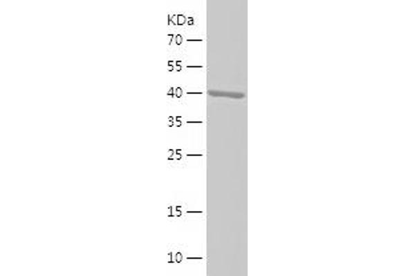 C8A Protein (AA 195-374) (His-IF2DI Tag)