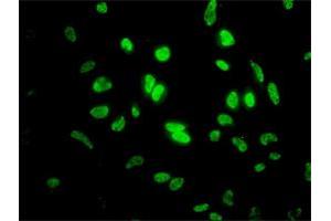 Immunofluorescence (IF) image for anti-Inhibitor of DNA Binding 1, Dominant Negative Helix-Loop-Helix Protein (ID1) (AA 1-155) antibody (ABIN561408)