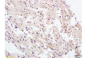 Formalin-fixed and paraffin embedded rat heart labeled with Anti-UBL7 Polyclonal Antibody, Unconjugated  at 1:100 followed by conjugation to the secondary antibody and DAB staining (UBL7 抗体  (AA 51-150))