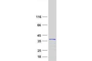 Western Blotting (WB) image for Kv Channel Interacting Protein 4 (KCNIP4) (Transcript Variant 6) protein (Myc-DYKDDDDK Tag) (ABIN2724032)