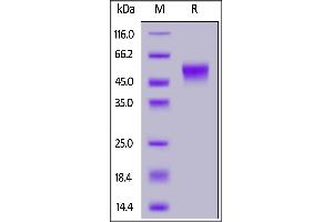 SDS-PAGE (SDS) image for Fc Fragment of IgG, Low Affinity IIIb, Receptor (CD16b) (FCGR3B) (AA 17-200) protein (His tag,SUMO Tag) (ABIN7013669)
