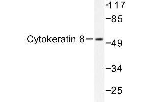 Image no. 1 for anti-Keratin 8 (KRT8) antibody (ABIN272030) (KRT8 抗体)