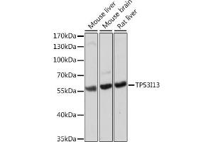 Western blot analysis of extracts of various cell lines, using TP53I13 antibody (ABIN7271098) at 1:1000 dilution. (TP53I13 抗体  (AA 180-310))
