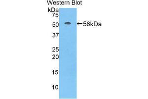 Western Blotting (WB) image for anti-Acidic (Leucine-Rich) Nuclear phosphoprotein 32 Family, Member A (ANP32A) (AA 2-247) antibody (ABIN1858013) (PHAP1 抗体  (AA 2-247))