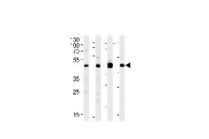 MEK1 Antibody (M1) (ABIN1882177 and ABIN2842020) western blot analysis in Jurkat,PC-12,rat C6 cell line and mouse brain lysates (35 μg/lane).