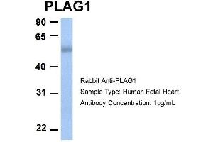 Host:  Rabbit  Target Name:  PLAG1  Sample Type:  Human Fetal Heart  Antibody Dilution:  1. (PLAG1 抗体  (N-Term))