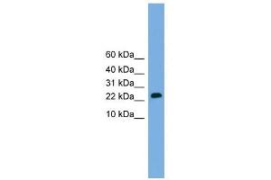 CSH2 antibody used at 1 ug/ml to detect target protein.