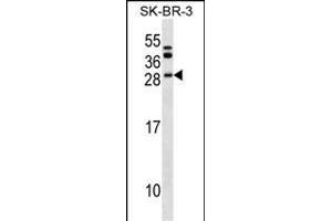 BCL7C Antibody (N-term) (ABIN1539556 and ABIN2849559) western blot analysis in SK-BR-3 cell line lysates (35 μg/lane). (BCL7C 抗体  (N-Term))