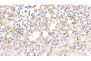 Immunohistochemistry (IHC) image for anti-Hemoglobin beta (HBB) (AA 1-147) antibody (ABIN7437341)