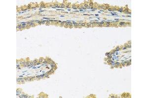 Immunohistochemistry of paraffin-embedded Human prostate using CRHBP Polyclonal Antibody at dilution of 1:100 (40x lens). (CRHBP 抗体)